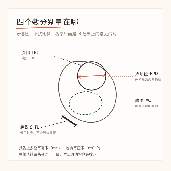 双顶径、头围、腹围、股骨长四个测量位置示意示意图